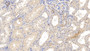 DAB staining on IHC-P; Sample: Human Kidney Tissue; Primary Ab: 20ug/ml Mouse Anti-Human MMP8 Antibody; Second Ab: 2ug/mL HRP-Linked Caprine Anti-Mouse IgG Polyclonal Antibody