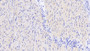 DAB staining on IHC-P; Sample: Human Cardiac Muscle Tissue; Primary Ab: 20ug/ml Mouse Anti-Human ADP Antibody Second Ab: 2ug/mL HRP-Linked Caprine Anti-Mouse IgG Polyclonal Antibody