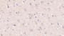 DAB staining on IHC-P; Sample: Human Cerebrum Tissue; Primary Ab: 40ug/ml Mouse Anti-Human MOG Antibody Second Ab: 2ug/mL HRP-Linked Caprine Anti-Mouse IgG Polyclonal Antibody