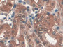 DAB staining on IHC-P; Sample: Human Stomach Tissue; Primary Ab: 30ug/ml Mouse Anti-Human PGA Antibody Second Ab: 2ug/mL HRP-Linked Caprine Anti-Mouse IgG Polyclonal Antibody