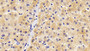 DAB staining on IHC-P; Sample: Human Liver Tissue; Primary Ab: 20ug/ml Mouse Anti-Human AT Antibody Second Ab: 2ug/mL HRP-Linked Caprine Anti-Mouse IgG Polyclonal Antibody