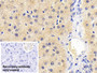 DAB staining on IHC-P; Sample: Human Liver Tissue; Primary Ab: 20ug/ml Mouse Anti-Human AT Antibody; Control: Used PBS instead of primary antibody; Second Ab: 2ug/ml HRP-Linked Caprine Anti-Mouse IgG Polyclonal Antibody