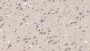 DAB staining on IHC-P; Sample: Porcine Cerebrum Tissue; Primary Ab: 10ug/ml Mouse Anti-Human LCAT Antibody; Second Ab: 2ug/mL HRP-Linked Caprine Anti-Mouse IgG Polyclonal Antibody