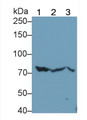 Western Blot; Sample: Lane1: Rat Liver lysate; Lane2: Rat Testis lysate; Lane3: A549 cell lysate Primary Ab: 2ug/ml Mouse Anti-Mouse HSPA5 Antibody Second Ab: 0.2ug/mL HRP-Linked Caprine Anti-Mouse IgG Polyclonal Antibody