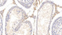DAB staining on IHC-P; Sample: Rat Testis Tissue; Primary Ab: 10ug/ml Mouse Anti-Rat APOE Antibody Second Ab: 2ug/mL HRP-Linked Caprine Anti-Mouse IgG Polyclonal Antibody