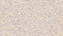 DAB staining on IHC-P; Sample: Rat Liver Tissue; Primary Ab: 10ug/ml Mouse Anti-Rat APOE Antibody; Second Ab: 2ug/mL HRP-Linked Caprine Anti-Mouse IgG Polyclonal Antibody