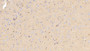 DAB staining on IHC-P; Sample: Rat Cerebrum Tissue; Primary Ab: 10ug/ml Mouse Anti-Rat APOE Antibody; Second Ab: 2ug/mL HRP-Linked Caprine Anti-Mouse IgG Polyclonal Antibody