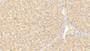 DAB staining on IHC-P; Sample: Human Liver Tissue; Primary Ab: 20ug/ml Mouse Anti-Human ALT Antibody; Second Ab: 2ug/mL HRP-Linked Caprine Anti-Mouse IgG Polyclonal Antibody
