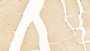 DAB staining on IHC-P; Sample: Human Skeletal muscle Tissue; Primary Ab: 20ug/ml Mouse Anti-Human ALT Antibody; Second Ab: 2ug/mL HRP-Linked Caprine Anti-Mouse IgG Polyclonal Antibody