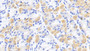 DAB staining on IHC-P; Sample: Human Stomach Tissue; Primary Ab: 20ug/ml Mouse Anti-Human CK-BB Antibody Second Ab: 2ug/mL HRP-Linked Caprine Anti-Mouse IgG Polyclonal Antibody