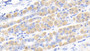 DAB staining on IHC-P; Sample: Human Stomach Tissue; Primary Ab: 20ug/ml Mouse Anti-Human CK-BB Antibody Second Ab: 2ug/mL HRP-Linked Caprine Anti-Mouse IgG Polyclonal Antibody
