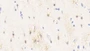 DAB staining on IHC-P; Sample: Human Cerebrum Tissue; Primary Ab: 20ug/ml Mouse Anti-Human CK-BB Antibody; Second Ab: 2ug/mL HRP-Linked Caprine Anti-Mouse IgG Polyclonal Antibody