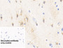 DAB staining on IHC-P; Sample: Human Cerebrum Tissue; Primary Ab: 20ug/ml Mouse Anti-Human CK-BB Antibody; Control: Used PBS instead of primary antibody; Second Ab: 2ug/ml HRP-Linked Caprine Anti-Mouse IgG Polyclonal Antibody