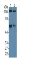 Western Blot; Sample: Lane1: Rat Serum; Lane2: Rat Plasma Primary Ab: 3ug/ml Mouse Anti-Human C5a Antibody Second Ab: 0.2ug/mL HRP-Linked Caprine Anti-Mouse IgG Polyclonal Antibody