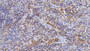 DAB staining on IHC-P; Sample: Human Spleen Tissue; Primary Ab: 10ug/ml Mouse Anti-Human FTH Antibody Second Ab: 2ug/mL HRP-Linked Caprine Anti-Mouse IgG Polyclonal Antibody