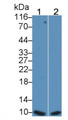 Western Blot; Sample: Lane1: HT1080 cell lysate; Lane2: HepG2 cell lysate Primary Ab: 0.2ug/ml Mouse Anti-Human S100 Antibody Second Ab: 0.2ug/mL HRP-Linked Caprine Anti-Mouse IgG Polyclonal Antibody