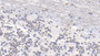 DAB staining on IHC-P; Sample: Human Cerebellum Tissue; Primary Ab: 20ug/ml Mouse Anti-Human S100B Antibody Second Ab: 2ug/mL HRP-Linked Caprine Anti-Mouse IgG Polyclonal Antibody