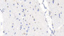 DAB staining on IHC-P; Sample: Human Cerebrum Tissue; Primary Ab: 20ug/ml Mouse Anti-Human S100B Antibody; Second Ab: 2ug/mL HRP-Linked Caprine Anti-Mouse IgG Polyclonal Antibody
