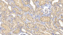 DAB staining on IHC-P; Sample: Human Kidney Tissue; Primary Ab: 40ug/ml Mouse Anti-Human Smad3 Antibody Second Ab: 2ug/mL HRP-Linked Caprine Anti-Mouse IgG Polyclonal Antibody