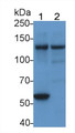 Western Blot; Sample: Lane1: Human Lung lysate; Lane2: Jurkat cell lysate Primary Ab: 3ug/ml Mouse Anti-Human FAK Antibody Second Ab: 0.2ug/mL HRP-Linked Caprine Anti-Mouse IgG Polyclonal Antibody