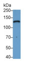 Western Blot; Sample: A431 cell lysate Primary Ab: 2ug/ml Mouse Anti-Human LAMC2 Antibody Second Ab: 0.2ug/mL HRP-Linked Caprine Anti-Mouse IgG Polyclonal Antibody