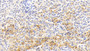 DAB staining on IHC-P; Sample: Rabbit Spleen Tissue; Primary Ab: 20ug/ml Mouse Anti-Rabbit IL18 Antibody; Second Ab: 2ug/mL HRP-Linked Caprine Anti-Mouse IgG Polyclonal Antibody
