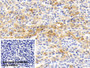 DAB staining on IHC-P; Sample: Rabbit Spleen Tissue; Primary Ab: 20ug/ml Mouse Anti-Rabbit IL18 Antibody; Control: Used PBS instead of primary antibody; Second Ab: 2ug/ml HRP-Linked Caprine Anti-Mouse IgG Polyclonal Antibody