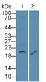 Western Blot; Sample: Lane1: Rat Thymus lysate; Lane2: Jurkat cell lysate Primary Ab: 2ug/ml Mouse Anti-Human IL7 Antibody Second Ab: 0.2ug/mL HRP-Linked Caprine Anti-Mouse IgG Polyclonal Antibody