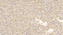 DAB staining on IHC-P; Sample: Human Liver Tissue; Primary Ab: 30ug/ml Mouse Anti-Human FTH Antibody Second Ab: 2ug/mL HRP-Linked Caprine Anti-Mouse IgG Polyclonal Antibody