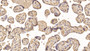DAB staining on IHC-P; Sample: Human Placenta Tissue; Primary Ab: 20ug/ml Mouse Anti-Human IGFBP1 Antibody Second Ab: 2ug/mL HRP-Linked Caprine Anti-Mouse IgG Polyclonal Antibody