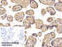 DAB staining on IHC-P; Sample: Human Placenta Tissue; Primary Ab: 20ug/ml Mouse Anti-Human IGFBP1 Antibody; Control: Used PBS instead of primary antibody; Second Ab: 2ug/ml HRP-Linked Caprine Anti-Mouse IgG Polyclonal Antibody