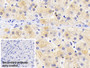 DAB staining on IHC-P; Sample: Human Liver Tissue; Primary Ab: 20ug/ml Mouse Anti-Human FTL Antibody; Control: Used PBS instead of primary antibody; Second Ab: 2ug/ml HRP-Linked Caprine Anti-Mouse IgG Polyclonal Antibody