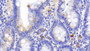DAB staining on IHC-P; Sample: Rat Small intestine Tissue; Primary Ab: 20ug/ml Mouse Anti-Rat CD163 Antibody; Second Ab: 2ug/mL HRP-Linked Caprine Anti-Mouse IgG Polyclonal Antibody