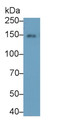 Western Blot; Sample: Rat Spleen lysate Primary Ab: 3ug/ml Mouse Anti-Rat CD163 Antibody Second Ab: 0.2ug/mL HRP-Linked Caprine Anti-Mouse IgG Polyclonal Antibody