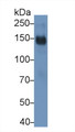 Western Blot; Sample: Rat Spleen lysate Primary Ab: 2ug/ml Mouse Anti-Rat CD163 Antibody Second Ab: 0.2ug/mL HRP-Linked Rabbit Anti-Mouse IgG Polyclonal Antibody