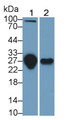 Western Blot; Sample: Lane1: Human Serum; Lane2: Human Urine Primary Ab: 2ug/ml Mouse Anti-Human TNFRSF10C Antibody Second Ab: 0.2ug/mL HRP-Linked Caprine Anti-Mouse IgG Polyclonal Antibody