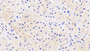 DAB staining on IHC-P; Sample: Human Cardiac Muscle Tissue; Primary Ab: 20ug/ml Mouse Anti-Human AST2 Antibody Second Ab: 2ug/mL HRP-Linked Caprine Anti-Mouse IgG Polyclonal Antibody