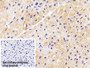 DAB staining on IHC-P; Sample: Human Cardiac Muscle Tissue; Primary Ab: 20ug/ml Mouse Anti-Human AST2 Antibody; Control: Used PBS instead of primary antibody; Second Ab: 2ug/ml HRP-Linked Caprine Anti-Mouse IgG Polyclonal Antibody