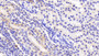 DAB staining on IHC-P; Sample: Human Kidney Tissue; Primary Ab: 20ug/ml Mouse Anti-Human AST2 Antibody; Second Ab: 2ug/mL HRP-Linked Caprine Anti-Mouse IgG Polyclonal Antibody