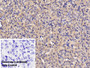 DAB staining on IHC-P; Sample: Rat Ovary Tissue; Primary Ab: 30ug/ml Mouse Anti-Human AMH Antibody; Control: Used PBS instead of primary antibody; Second Ab: 2ug/ml HRP-Linked Caprine Anti-Mouse IgG Polyclonal Antibody