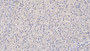 DAB staining on IHC-P; Sample: Human Liver Tissue; Primary Ab: 10ug/ml Mouse Anti-Human APOB Antibody Second Ab: 2ug/mL HRP-Linked Caprine Anti-Mouse IgG Polyclonal Antibody