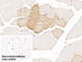 DAB staining on IHC-P; Sample: Human Skeletal muscle Tissue; Primary Ab: 10ug/ml Mouse Anti-Human TDO Antibody; Control: Used PBS instead of primary antibody; Second Ab: 2ug/ml HRP-Linked Caprine Anti-Mouse IgG Polyclonal Antibody