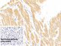 DAB staining on IHC-P; Sample: Human Cardiac Muscle Tissue; Primary Ab: 20ug/ml Mouse Anti-Human cTnI Antibody; Control: Used PBS instead of primary antibody; Second Ab: 2ug/ml HRP-Linked Caprine Anti-Mouse IgG Polyclonal Antibody