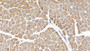 DAB staining on IHC-P; Samples: Porcine Cardiac Muscle Tissue; Primary Ab: 20ug/ml Mouse Anti-Porcine IL6 Antibody Second Ab: 2ug/mL HRP-Linked Caprine Anti-Mouse IgG Polyclonal Antibody