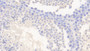 DAB staining on IHC-P; Sample: Mouse Testis Tissue; Primary Ab: 20ug/ml Rabbit Anti-Mouse PCDH18 Antibody; Second Ab: 2ug/mL HRP-Linked Caprine Anti-Rabbit IgG Polyclonal Antibody