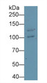 Western Blot; Sample: Hela cell lysate Primary Ab: 1.5ug/ml Mouse Anti-Human DSG3 Antibody Second Ab: 0.2ug/mL HRP-Linked Caprine Anti-Mouse IgG Polyclonal Antibody