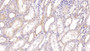DAB staining on IHC-P; Sample: Human Kidney Tissue; Primary Ab: 40ug/ml Mouse Anti-Human ASPH Antibody Second Ab: 2ug/mL HRP-Linked Caprine Anti-Mouse IgG Polyclonal Antibody