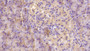 DAB staining on IHC-P; Sample: Human Pancreas Tissue; Primary Ab: 40ug/ml Mouse Anti-Human ASPH Antibody; Second Ab: 2ug/mL HRP-Linked Caprine Anti-Mouse IgG Polyclonal Antibody