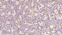 DAB staining on IHC-P; Sample: Human Small intestine Tissue; Primary Ab: 40ug/ml Mouse Anti-Human ASPH Antibody; Second Ab: 2ug/mL HRP-Linked Caprine Anti-Mouse IgG Polyclonal Antibody