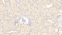DAB staining on IHC-P; Sample: Human Kidney Tissue; Primary Ab: 20ug/ml Mouse Anti-Human IL18 Antibody; Second Ab: 2ug/mL HRP-Linked Caprine Anti-Mouse IgG Polyclonal Antibody